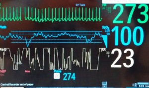Pediatrik Hastalarda Taşikardi Tedavisi