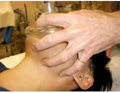 CE tekniği ile maske sabitleme